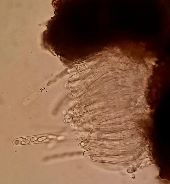 Venturia inaequalis, Čađava pegavost lišća i krastavost plodova jabuke, Apple scab, askus sa askosporama	
