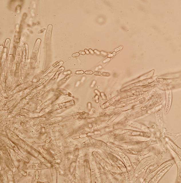 Venturia inaequalis, Čađava pegavost lišća i krastavost plodova jabuke, Apple scab
, askospore