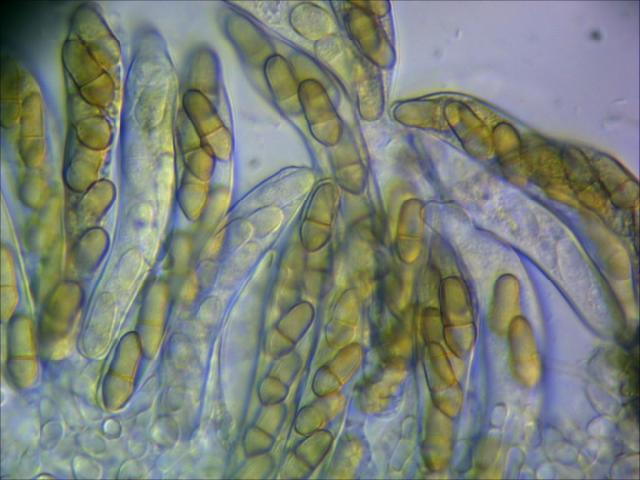 formiranje askospora u askusima na dan 26 mart 2014