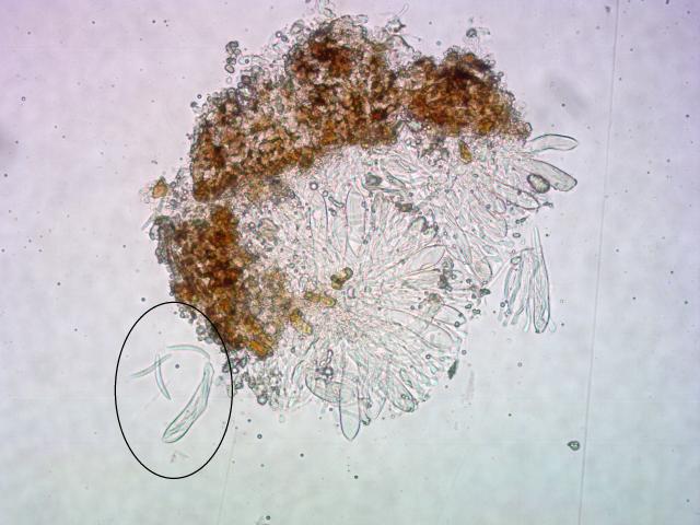 Formiranje askospora