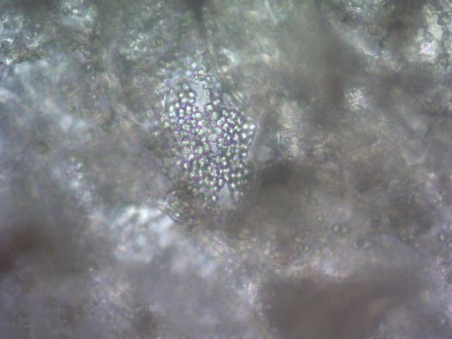 Izgled trajnih sorusa Phytophthora fragariae 