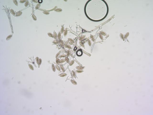 Peronospora destructor
