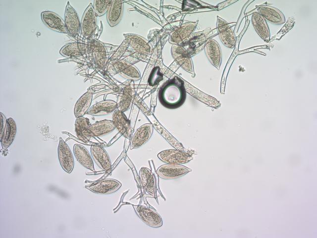 Peronospora destructor