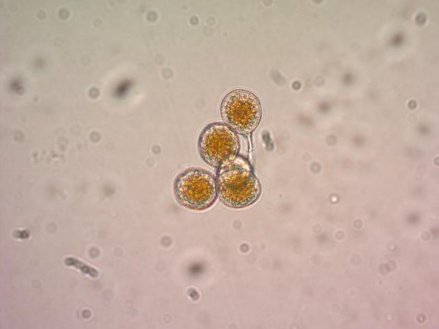 Spore Puccinia graminis