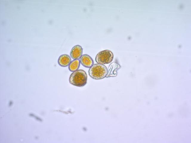 uredospore prouzrokovača rđe puccinia 