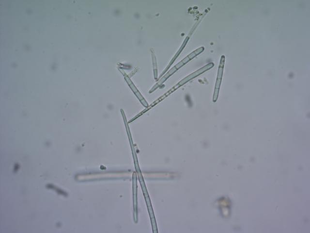 Cercospora beticola