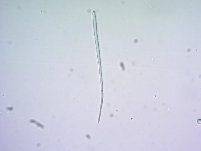 Cercospora beticola