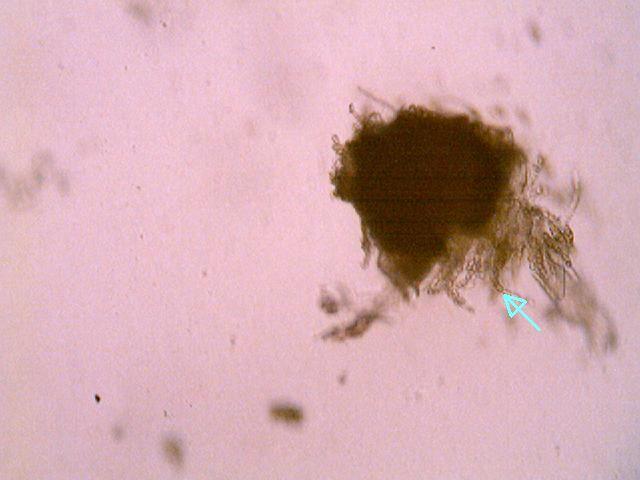 Laboratorijski pregled peritecija pod binokularom