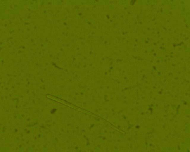konidije Cercospora beticola 