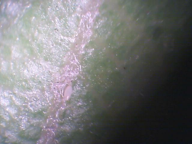 Laboratorijski pregled