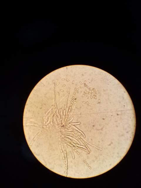 ascospore, Venturia inaequalis