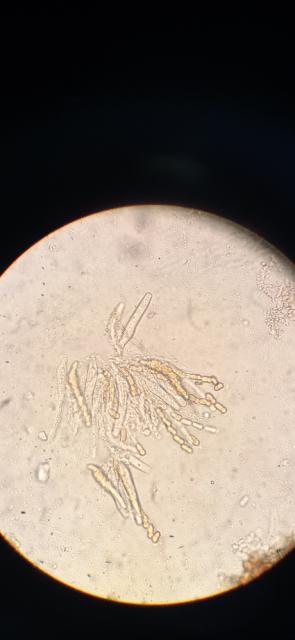 askospore, venturia inaequalis