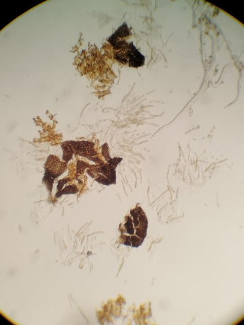 pseudotecije v.inaequalis