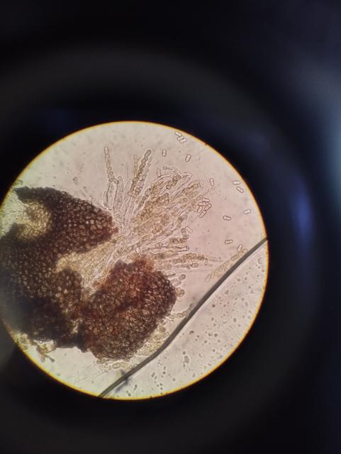 pseudotecija V.inaequalis