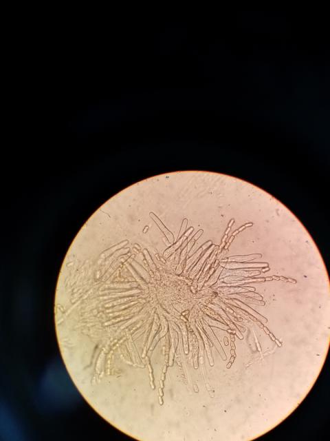 askospore,venturia inaequalis,jabuka