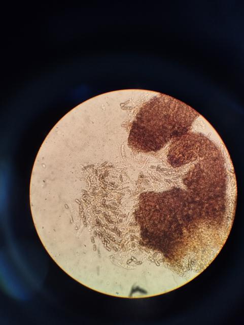 pseudotecija,venturua inaequalis