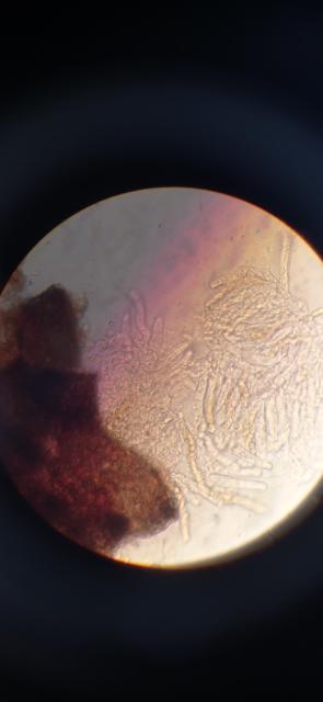 Askospore venturia inaequalis,jabuka