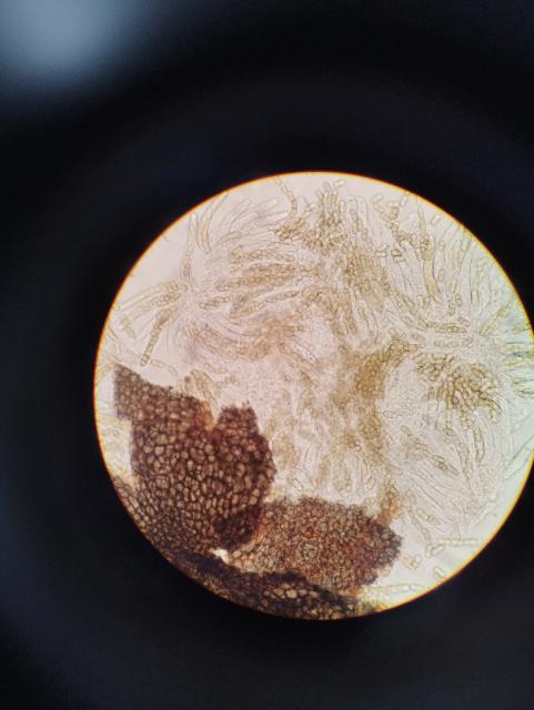 askospore,Venturia inaequalis,jabuka