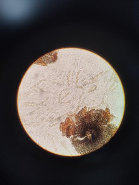 ascospore,venturia inaequalis