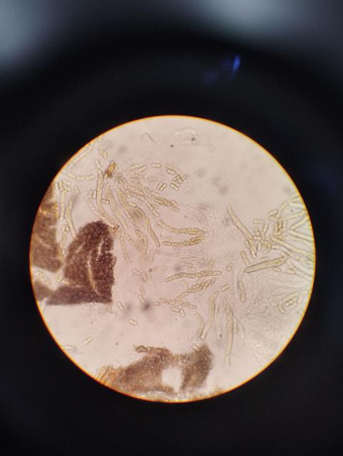 askospore venturia inaequalis,jabuka