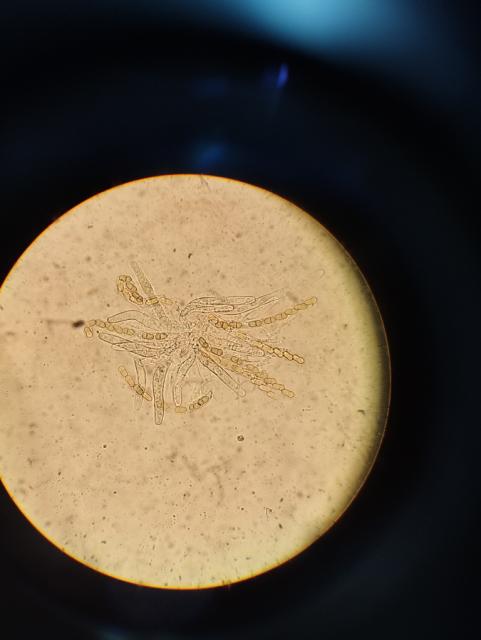 askospore Venturia inaequalis