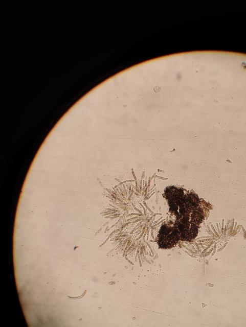 pseudotecija, Venturia inaequalis