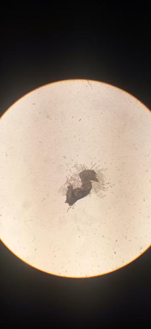 askospore Venturia inaequalis