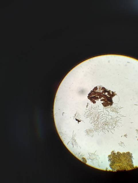 askospore venturia inaequalis,jabuka,apple