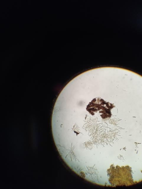 askospore,venturia inaequalis,jabuka,apple