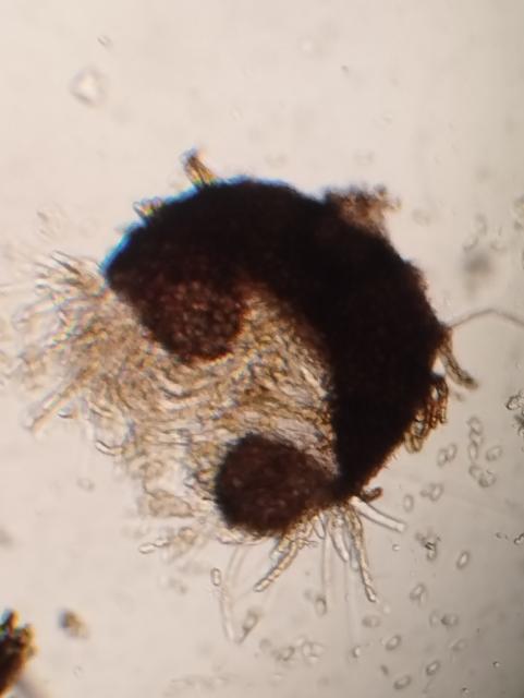 pseudotecija