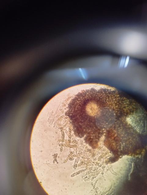 pseudotecija venturia inaequalis