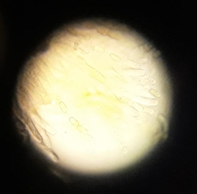 dozrele askospore u peritecijama, lokalitet Atenica